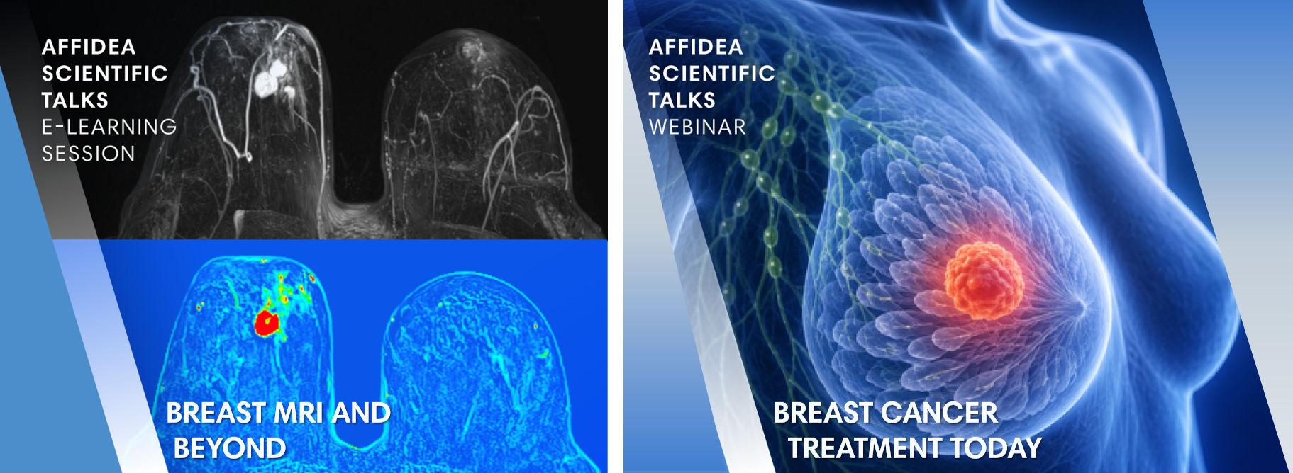 On-demand session Breast Care and Beyondr